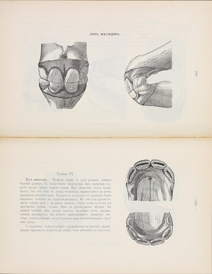 Губо А., Баррие Г. Экстерьер лошади / Пер. врача Н.А. Бухалова со 2-го фр. изд.; под ред. и с примеч. Л.А. Третьякова, ординарного проф. Казанского ветеринарного института по Кафедре зоотомии и экстерьера. Орел: Изд. книжного склада С.К. Живописцева, 1901.